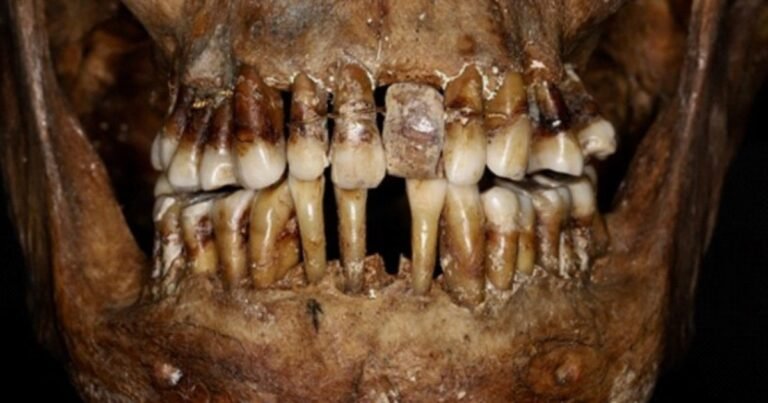 El ingenioso secreto para conservar sus dientes de una aristócrata del siglo XVII