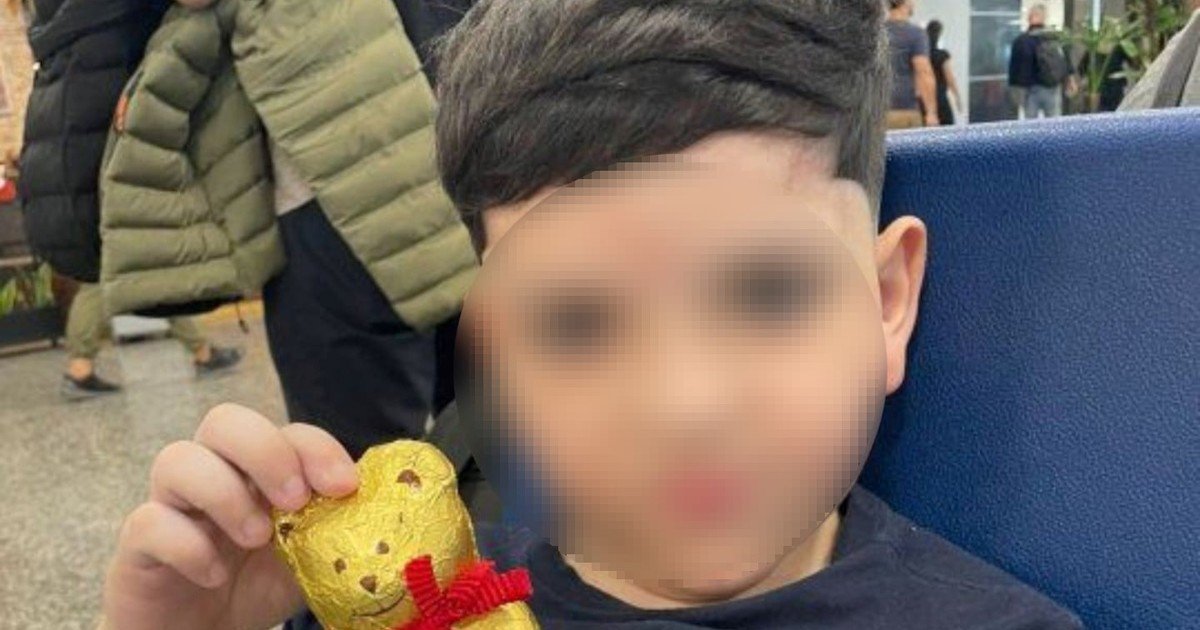 Qué es la traqueotomía que le practicaron a Bastián: la cirugía clave tras 14 días de asistencia mecánica para ayudarlo a respirar