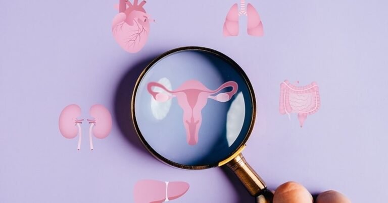 El nombre del síndrome de ovario poliquístico (SOP) cambia a síndrome ovárico metabólico poliendocrino (SOMP) para mejorar el diagnóstico y tratamiento que afecta a millones de mujeres