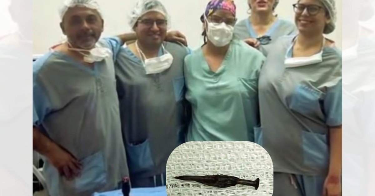 Lo llevaron al hospital por un golpe y se había tragado un clavo: en una cirugía inédita, se lo sacaron con imanes por el ombligo