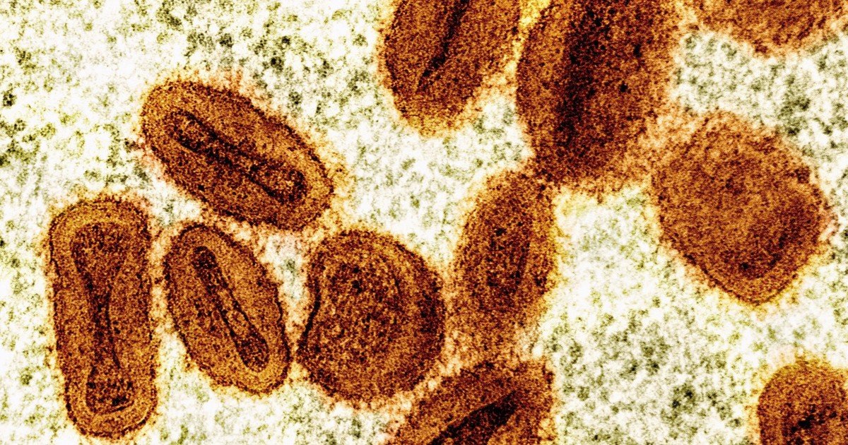 Acusan a dos científicos de introducir de contrabando virus de mpox desactivado en Estados Unidos y mentir a las autoridades