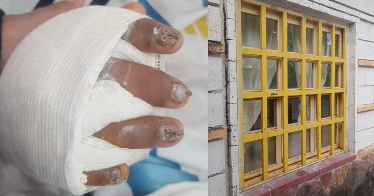 "Tiene el 95% de la mano destruida": una ventana cayó sobre un niño y la familia denunció que las instalaciones escolares estaban en mal estado