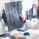 Inteligencia artificial vs. radiólogos: un ensayo clínico busca saber si la IA puede diagnosticar cáncer de próstata