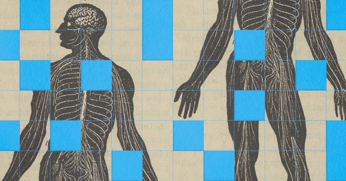Enigma médico: cataratas, presbicia o ACV, ¿qué tiene este paciente?