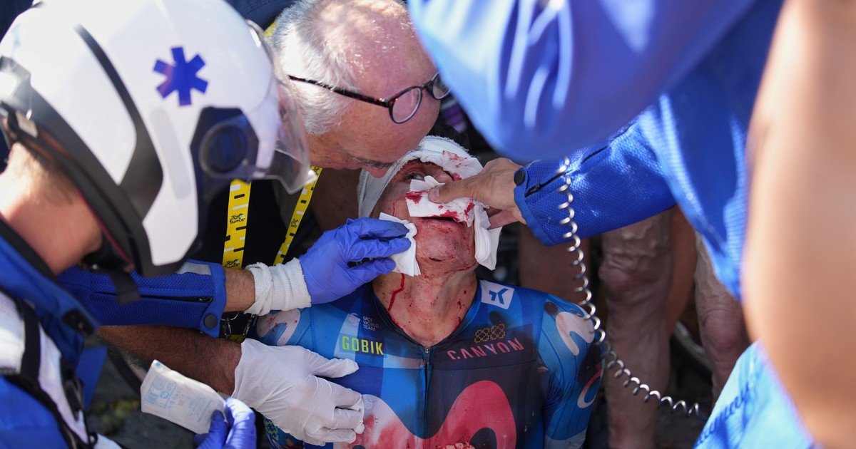 Dramático accidente de Einer Rubio en el Tour de Francia: chocó contra un auto por un insólito motivo y terminó con 20 puntos en la cara