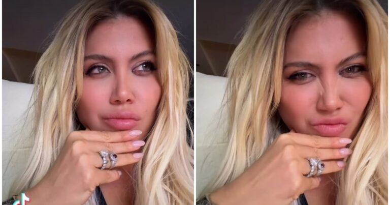 Wanda Nara abrió un debate entre sus seguidores sobre un retoque estético: "¿Qué dicen? ¿Me los saco?”