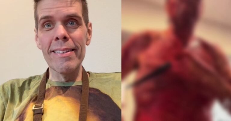 Perturbador video | Perez Hilton fue hospitalizado tras autolesionarse con un cuchillo en un livestream de TikTok: el reporte de la policía