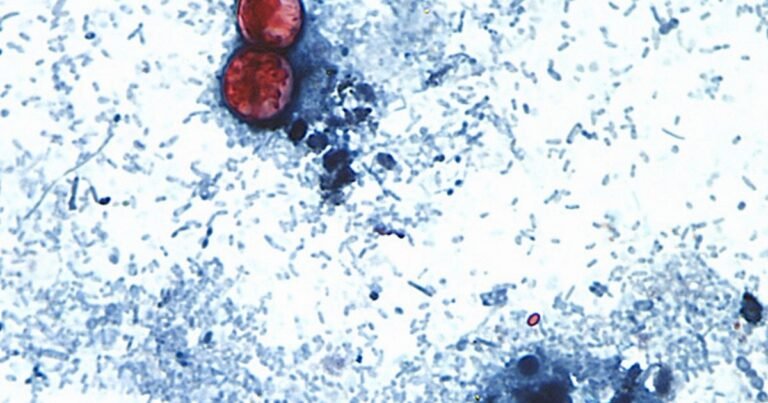 Qué es la Cyclospora, el parásito hallado en la lechuga contaminada que provoca diarrea y otros síntomas